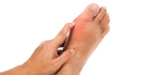 Person pointing to their foot gout